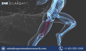 Read more about the article Trauma Products Market Size, Share, Price, Trends, Growth, Analysis, Report and Forecast 2024-2032